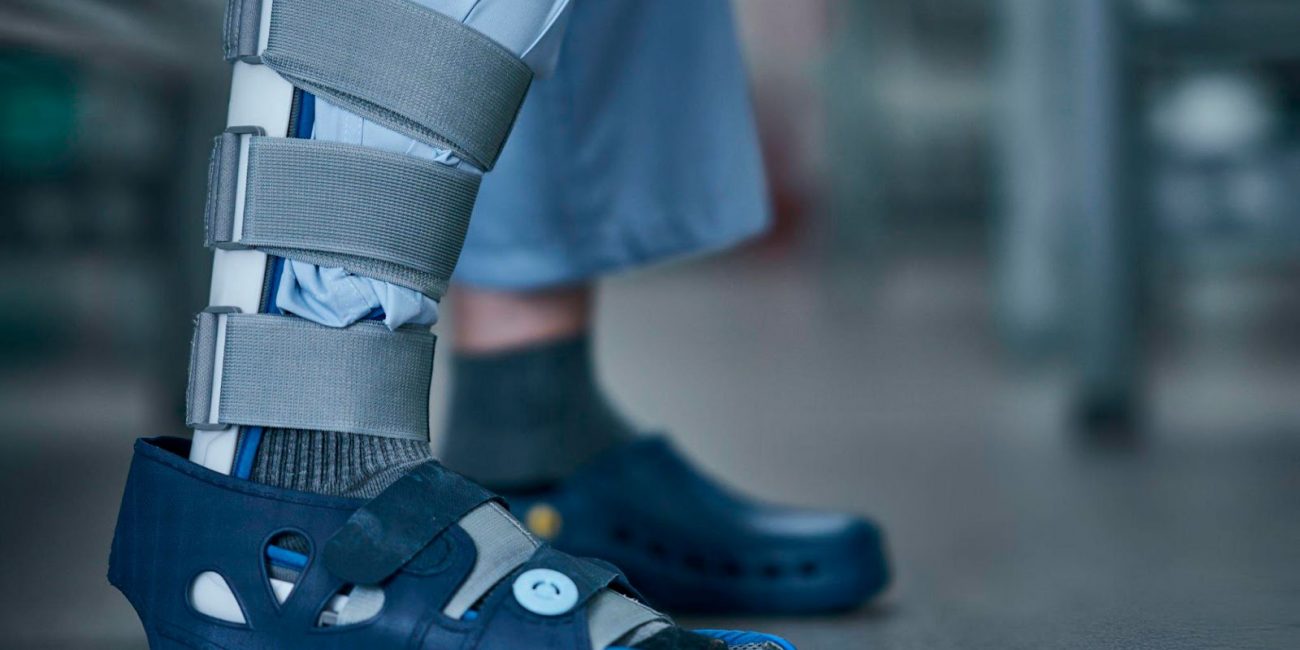 Как правильно выбрать и использовать современный фиксатор для нижних конечностей