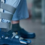 Как правильно выбрать и использовать современный фиксатор для нижних конечностей