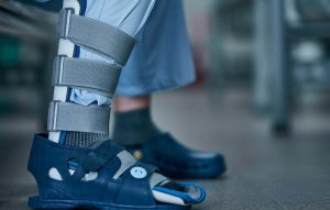 Как правильно выбрать и использовать современный фиксатор для нижних конечностей